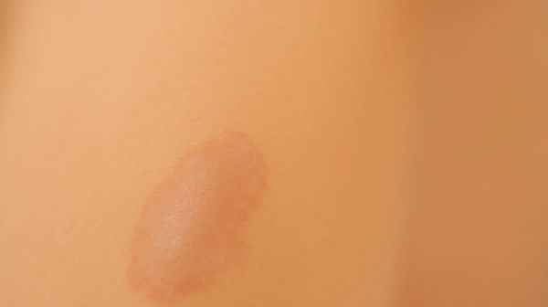 Améliorer votre épilation laser pour des résultats durables